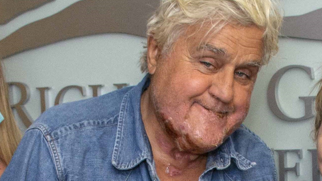 Jay Leno Seen In First Photo Since Suffering 3rd Degree Burns And Being   Leno With The GBC Staff Copy1 